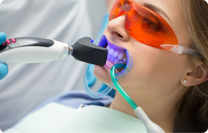 Mantén por más tiempo tu blanqueamiento dental
